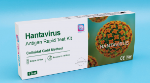 Hantavirus Antigen Rapid Test Kit