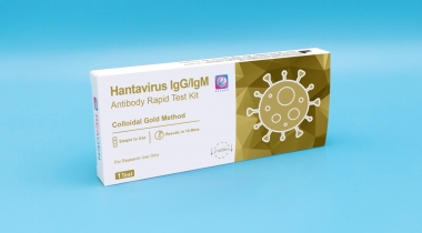 Hantavirus IgG/IgM Antibody Rapid Test Kit