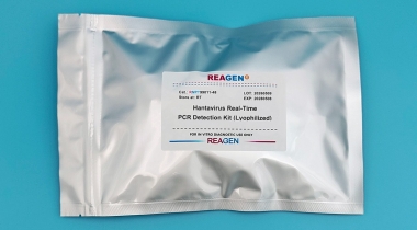 Hantavirus Real-Time PCR Detection Kit Manual (Lyophilized)