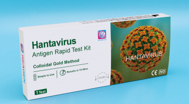 Hantavirus Antigen Rapid Test Kit
